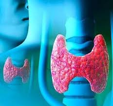 cauzele tiroidei cronice